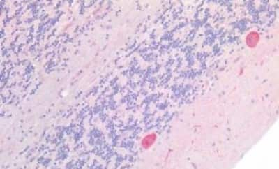 Immunohistochemistry-Paraffin: ATG16L1 Antibody [NBP3-14544]